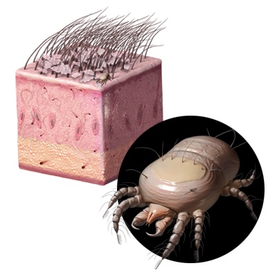 flea and ticks