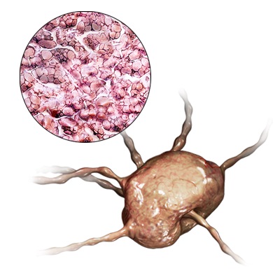Lymph Node- Atlas Pet Hospital